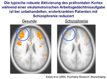 Augenfolgebewegungen in der funktionellen Magnetresonanztomographie