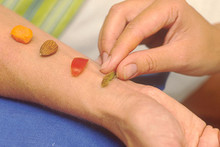 Allergietest